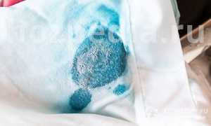 Как отстирать зеленку с одежды